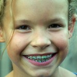 Reliving the Orthodontia Journey
