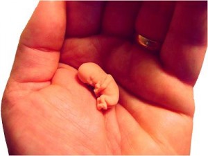 8-week_fetus unborn_baby abortion