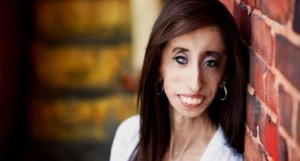 Lizzie-Velasquez