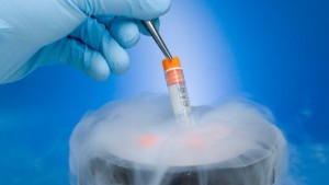 frozen embryo