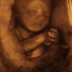 The Unborn Baby: Watched by the White House, Blessed by the Church
