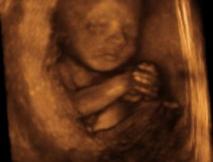 unborn baby 26 weeks